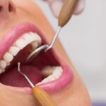 De ce evită românii medicul dentist: bariere psihologice și cum pot fi depășite